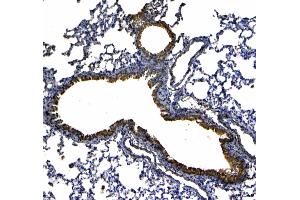 IHC analysis of Uteroglobin using anti-Uteroglobin antibody . (SCGB1A1 antibody  (AA 20-96))