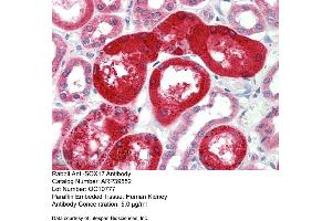 Rabbit Anti-SOX17 Antibody  Paraffin Embedded Tissue: Human Kidney Antibody Concentration: 5 ug/ml (SOX17 antibody  (Middle Region))