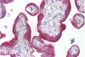 Immunohistochemistry with Placenta tissue at an antibody concentration of 5µg/ml using anti-KRT23 antibody (ARP47466_P050) (KRT23 antibody  (Middle Region))