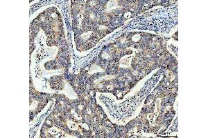 IHC analysis of TOMM20 using anti-TOMM20 antibody (ABIN7600883).