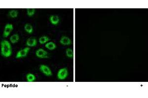 Immunofluorescence analysis of A-549 cells, using ATP5D polyclonal antibody . (ATP5F1D antibody)