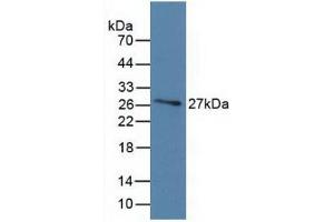 Detection of Recombinant DBP, Human using Monoclonal Antibody to Vitamin D Binding Protein (DBP) (Vitamin D-Binding Protein antibody  (AA 209-401))
