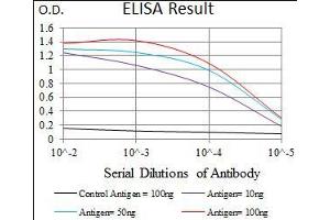 Black line: Control Antigen (100 ng), Purple line: Antigen(10 ng), Blue line: Antigen (50 ng), Red line: Antigen (100 ng), (FOXC2 antibody  (AA 21-210))