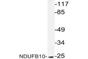 Western blot (WB) analysis of NDUFB10 antibody in extracts from COLO cells. (NDUFB10 antibody)