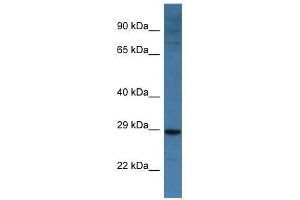 Western Blot showing Bnip3l antibody used at a concentration of 1. (BNIP3L/NIX antibody  (Middle Region))