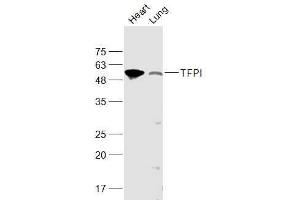 Lane 1: Mouse Heart lysates Lane 2: Rat Lung lysates probed with TFPI Polyclonal Antibody, Unconjugated  at 1:1000 dilution and 4˚C overnight incubation. (TFPI antibody  (AA 101-200))