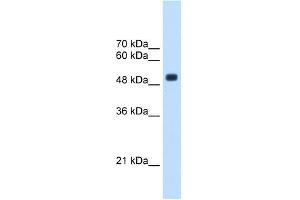 CXORF34 antibody used at 2. (TRMT2B antibody  (Middle Region))