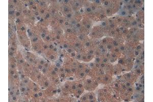 Detection of GaA in Human Liver Tissue using Polyclonal Antibody to Glucosidase Alpha, Acid (GaA) (GAA antibody  (AA 595-770))