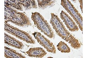 IHC analysis of FOSB using anti-FOSB antibody (ABIN3042399).