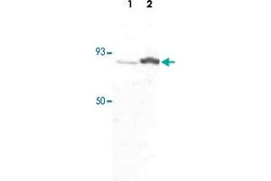 Western blot was performed using whole cell extracts (WCE) from drosophila larva (Lane 1) and drosophila adults (Lane 2) and the CDC73 polyclonal antibody  at dilution 1 : 1,000 in TBS-Tween + 5% skimmed milk.
