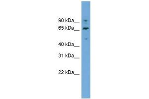 WB Suggested Anti-NT5DC2 Antibody Titration:  0.