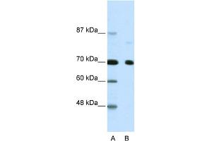 WB Suggested Anti-NCOR2 Antibody Titration:  2. (NCOR2 antibody  (N-Term))