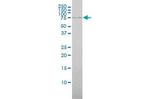 Western Blotting (WB) image for anti-ATP-Binding Cassette, Sub-Family F (GCN20), Member 2 (ABCF2) (AA 1-110) antibody (ABIN564348)