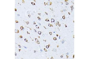 Immunohistochemistry of paraffin-embedded rat brain using BiP/GRP78 antibody (ABIN3020762, ABIN3020763, ABIN3020764, ABIN1512637 and ABIN6213711) at dilution of 1:100 (40x lens). (GRP78 antibody  (AA 550-650))