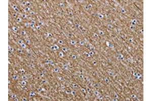 The image is immunohistochemistry of paraffin-embedded Human brain tissue using ABIN7191618(NEFM Antibody) at dilution 1/20. (NEFM antibody)