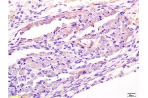 Formalin-fixed and paraffin embedded mouse embryo labeled with Anti-Wnt1 Polyclonal Antibody, Unconjugated (ABIN733748) at 1:200 followed by conjugation to the secondary antibody and DAB staining. (WNT1 antibody  (AA 251-350))