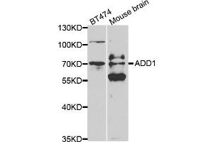 Western blot analysis of extracts of various cell lines, using ADD1 antibody (ABIN5970770) at 1/500 dilution. (alpha Adducin antibody)