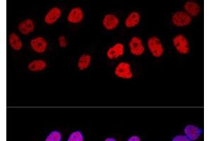 Confocal immunofluorescence analysis of HeLa cells using DNMT1 Polyclonal Antibody at dilution of 1:100. (DNMT1 antibody)