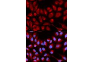 Immunofluorescence analysis of U2OS cell using IL16 antibody. (IL16 antibody  (AA 1-305))