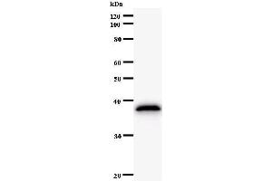 Western Blotting (WB) image for anti-NDC80 Kinetochore Complex Component Homolog (NDC80) antibody (ABIN931089) (NDC80 antibody)