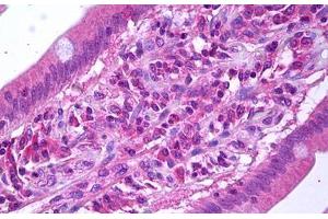 Anti-VEGFR3 antibody IHC staining of human small intestine. (FLT4 antibody)