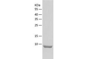 Western Blotting (WB) image for Osteocrin (OSTN) (AA 28-133) protein (His tag) (ABIN7286650) (Osteocrin Protein (OSTN) (AA 28-133) (His tag))