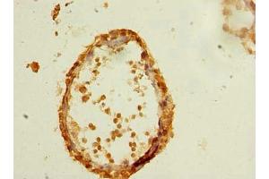 Immunohistochemistry of paraffin-embedded human testis tissue using ABIN7147768 at dilution of 1:100 (CFAP61 antibody  (AA 1-200))