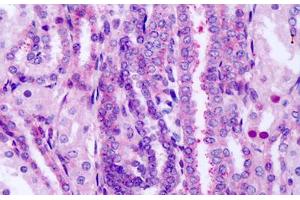 Anti-FZD8 / Frizzled 8 antibody IHC staining of human fetal kidney. (FZD8 antibody  (Extracellular Domain))