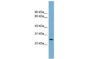 LIN37 antibody used at 1 ug/ml to detect target protein. (LIN37 antibody)