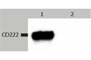 Western Blotting analysis (non-reducing conditions) of CD222 in whole cell lysate of JURKAT human peripheral blood T cell leukemia cell line. (IGF2R antibody  (FITC))