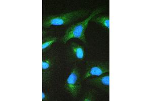 IF analysis of CCT2 using anti-CCT2 antibody (ABIN4886512).