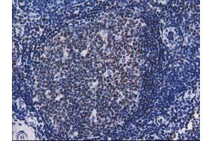 Image no. 2 for anti-CTD (Carboxy-terminal Domain, RNA Polymerase II, Polypeptide A) Small Phosphatase 1 (CTDSP1) antibody (ABIN1497678) (CTDSP1 antibody)