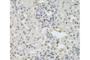 Immunohistochemistry of paraffin-embedded Rat kidney using DR1 Polyclonal Antibody at dilution of 1:100 (40x lens). (DR1 antibody)