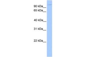 Western Blotting (WB) image for anti-Nucleoporin 98kDa (NUP98) antibody (ABIN2463586) (NUP98 antibody)