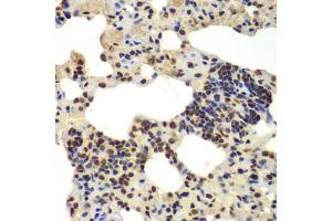 Immunohistochemistry of paraffin-embedded rat lung using DDX5 antibody (ABIN6291987) at dilution of 1:100 (40x lens). (DDX5 antibody)