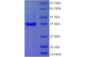 SDS-PAGE (SDS) image for Glutaminyl-Peptide Cyclotransferase-Like (QPCTL) (AA 212-382), (partial) protein (His-SUMO Tag) (ABIN4974788)