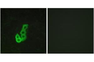 Immunofluorescence analysis of MCF7 cells, using DRD1 Antibody. (Dopamine Receptor d1 antibody  (AA 135-184))