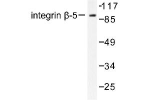 Image no. 1 for anti-Integrin beta 5 (ITGB5) antibody (ABIN265481)