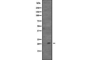 Western blot analysis of CDC42 expression in Hela cell lysate,The lane on the left is treated with the antigen-specific peptide. (CDC42 antibody  (Internal Region))