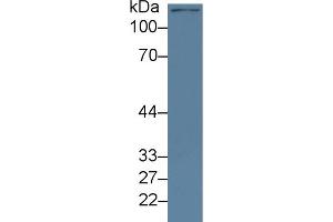 Western Blotting (WB) image for anti-Lysine (K)-Specific Demethylase 4A (KDM4A) (AA 141-310) antibody (ABIN7441397)