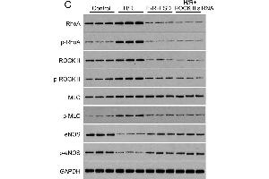 Fasudil protects HUVEC cells from H/R-induced apoptosis(A) MTT was used to determine the IC50 of FSD in HUVEC cells cultured in standard condition. (MYL9 antibody  (pThr19))