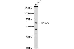 Western blot analysis of extracts of Rat lung, using TRIP2 antibody (ABIN6129947, ABIN6149464, ABIN6149465 and ABIN6222516) at 1:1000 dilution. (TRAF3IP2 antibody  (AA 1-300))