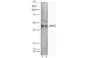 Lane 1: Human Raji lysates; Lane 2: Mouse spleen lysates probed with Rabbit Anti-ZNT8 Polyclonal Antibody, Unconjugated (ABIN1714639) at 1:300 overnight at 4˚C. (SLC30A8 antibody  (AA 101-200))