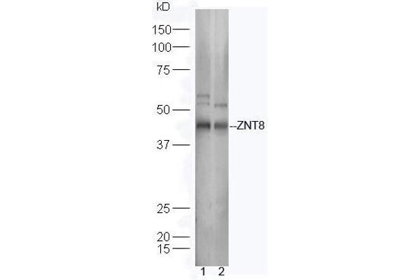 SLC30A8 Antikörper  (AA 101-200)