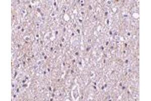 Immunohistochemistry of CTRP4 in human brain tissue with CTRP4 antibody at 10 μg/ml. (C1QTNF4 antibody  (N-Term))