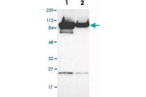 Western Blot analysis of Lane 1: RT-4 and Lane 2: U-251MG sp cell lysates with AKAP8 polyclonal antibody . (AKAP8 antibody)