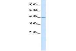 WB Suggested Anti-ZNFN1A2 Antibody Titration: 5. (IKZF2 antibody  (C-Term))