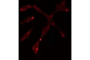 ABIN6275066 staining  Hela cells by IF/ICC. (POLD1 antibody  (C-Term))