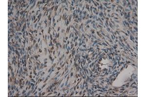 Immunohistochemical staining of paraffin-embedded kidney using anti-CPA1 (ABIN2452540) mouse monoclonal antibody. (CPA1 antibody  (AA 1-419))