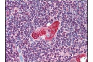 Image no. 1 for anti-T-Cell Leukemia Homeobox 1 (TLX1) (AA 300-330) antibody (ABIN372448)